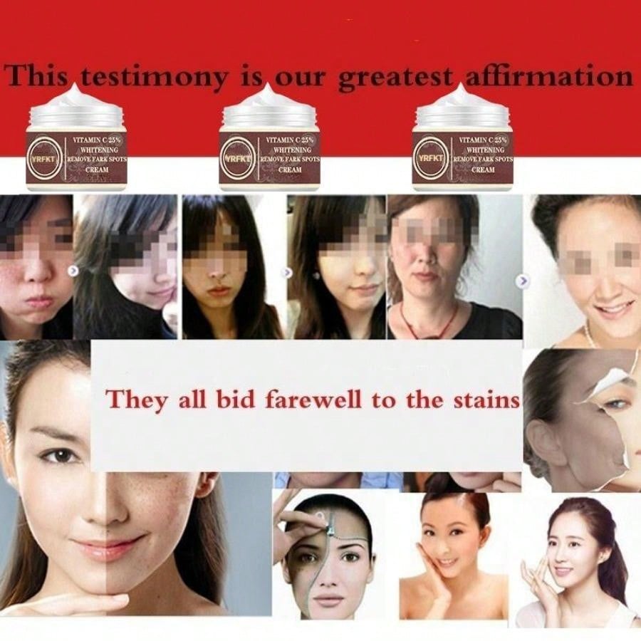 Women New Skin Brightening Cream&Freckle Cream&Dark Spot Corrector Remover for Face Blemishes