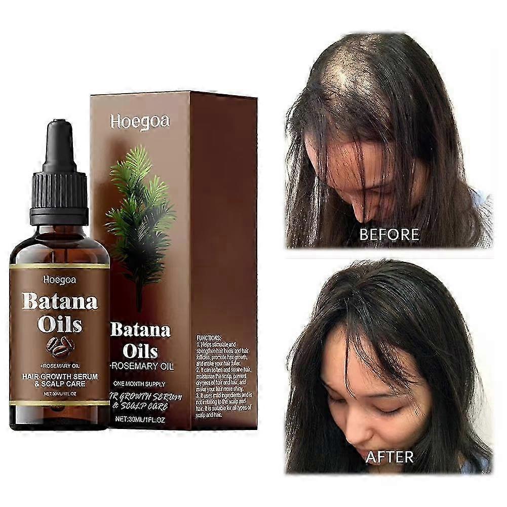suitable for batana oil with rosemary for hair growth, nourish scalp detox, organic, reduce hair los