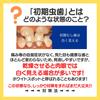 Smile Cosmetic Whitening with 1450ppm Fluoride for Cavity Teeth and Bad Breath Paste, 85ml, Prevention, Whitening, [Quasi-drug]