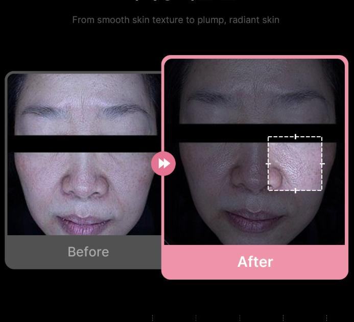 Medicube PDRN Pink Collagen Jelly Mist Serum 100ml – Stangrinantis ir drėkinantis švytėjimo purškiklis