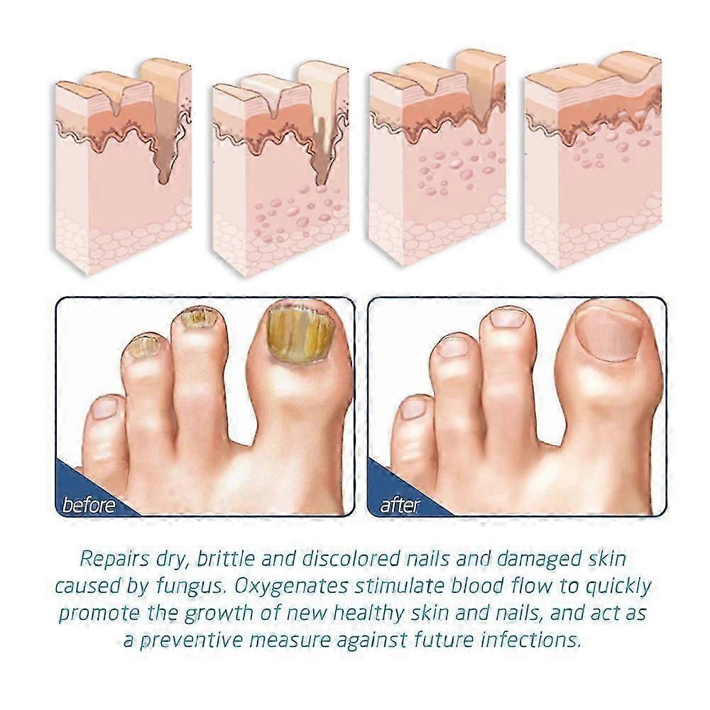 3pcs Foot And Spary, And Ful Foot Care-Min