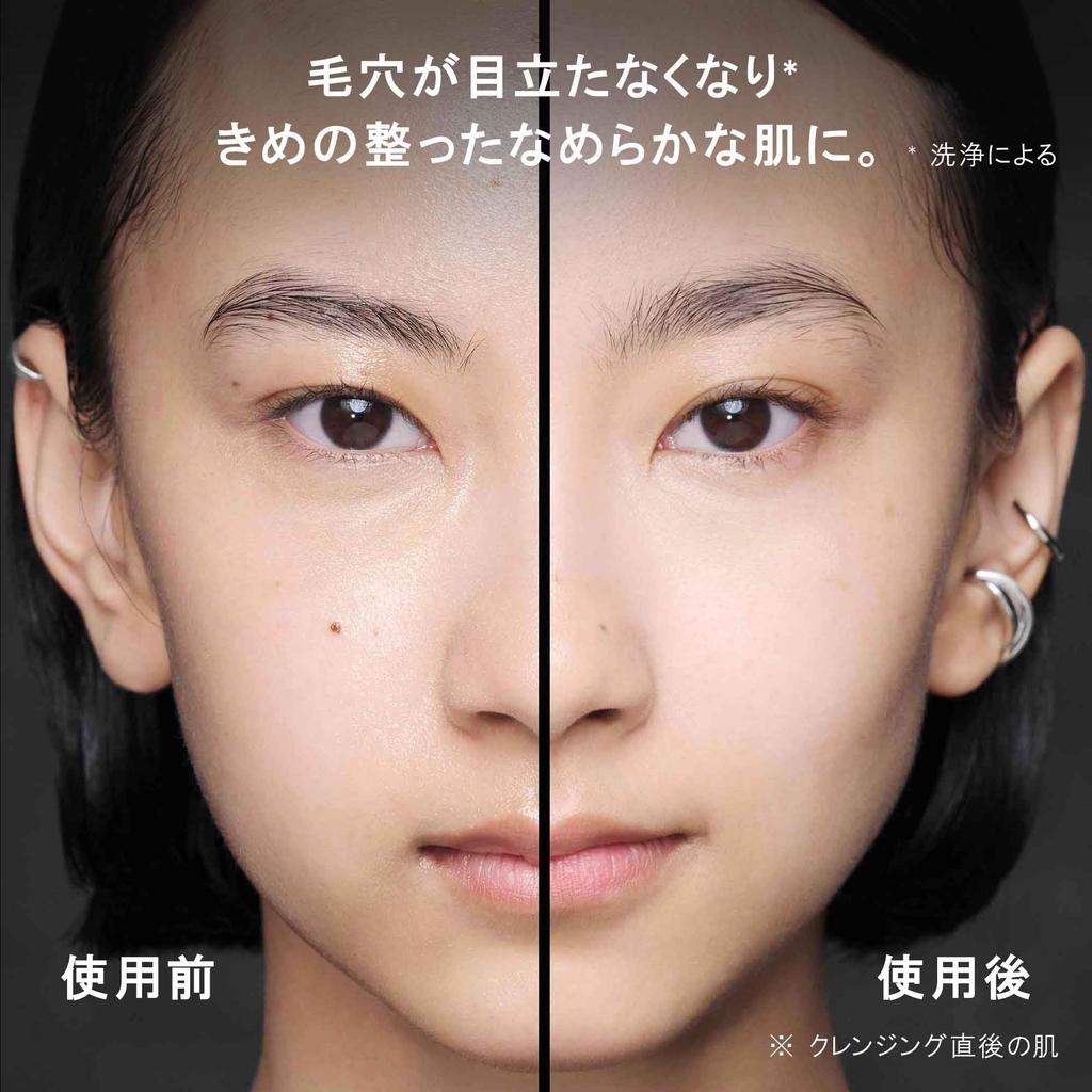 Shu Uemura Black Cleansing Oil, 150mL, Makeup Remover with Serum, Pore Cleansing, Blackhead Removal, Dullness Care, No Double Cleansing Required