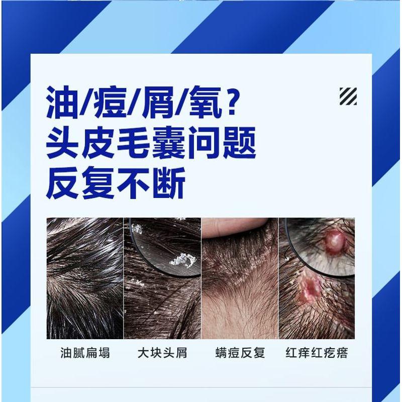 Z:SEA - Water Oil-Control & Anti-Acne Shampoo