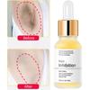 Permanent Hair Inhibition Serum Painless Hair Remover Armpit Legs Arms Hair Growth Inhibitor Depilatory Body Cream Care For Men