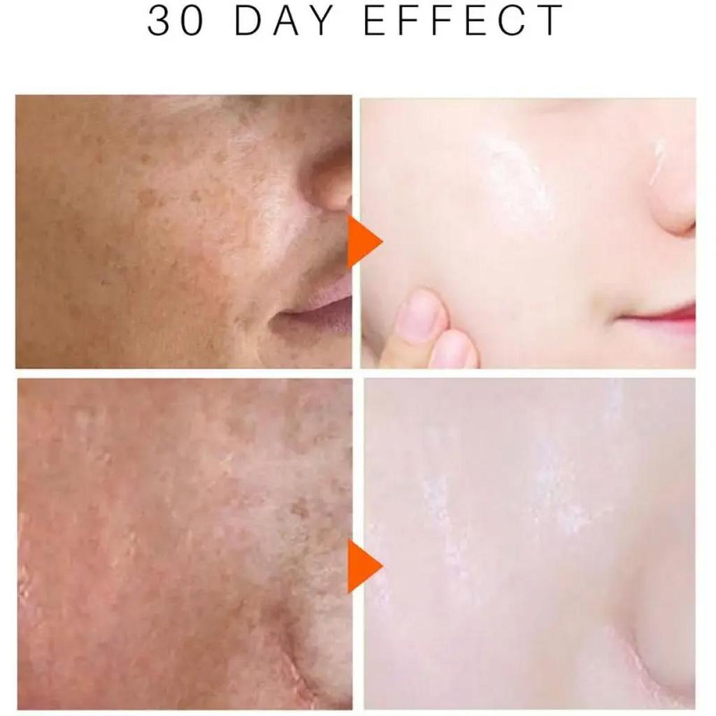 A Hydrating Moisturizing Cream To Make It Look Smoother and Less Wrinkled, an Essential Part of Your Daily Facial