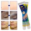 ZB Mole Removal Ointment Skin Care Mild Ingredients Collagen Daily Skin Care