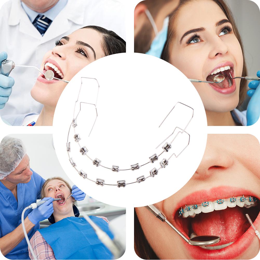 1 Pair Dental Fake Braces with Storage Box Temporary Tooth Decoration Colored Dental Decor Braces for Daily Tooth Protect