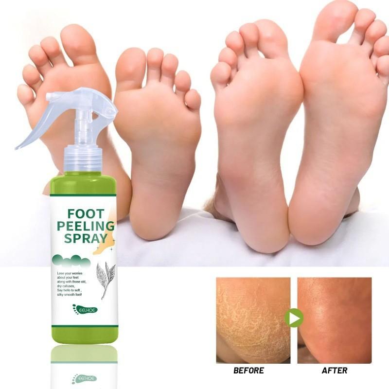 Eelhoe Exfoliating Care Spray With Green Tea And Citrus Scent For Soft Feet And Elbows