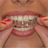 Anti Snoring Bruxism Sleeping Mouth Guard Night Guard Gum Shield Mouth Tray Stop Teeth Grinding Sleep Aid Health Care 3