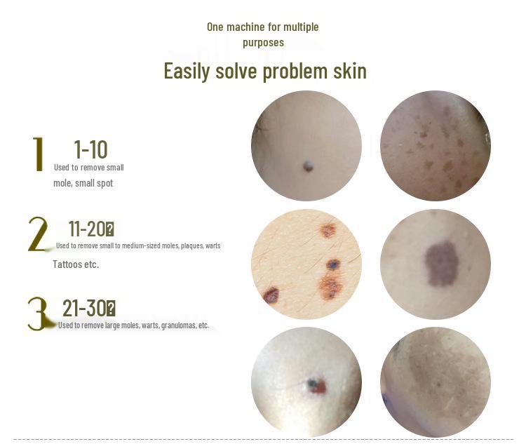 Park Si-yeon Laser Freckle & Mole Removal Pen for Home and Salon Use – Tattoo & Eyebrow Removal Device