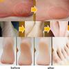 1PC Schönheit Produkt Pflanzliche Anti Riss Fuß Creme Ferse Riss Reparatur Produkte Peeling Abgestorbene Haut Entfernung Erweichung Befeuchten
