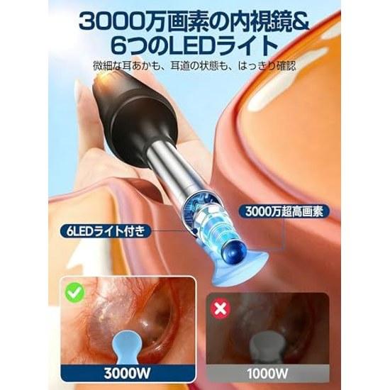 2026 Model 30 Million Pixels Ultra High resolutionAI Temperature Controlear Hook Tweezers Included Ear Cleaner Camera Cleaning Pick 360 Earwax Removal