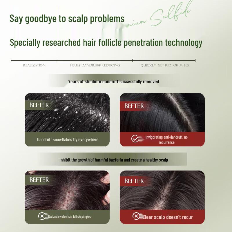 Layanana 1% Selenium Disulfide Anti-Dandruff Shampoo