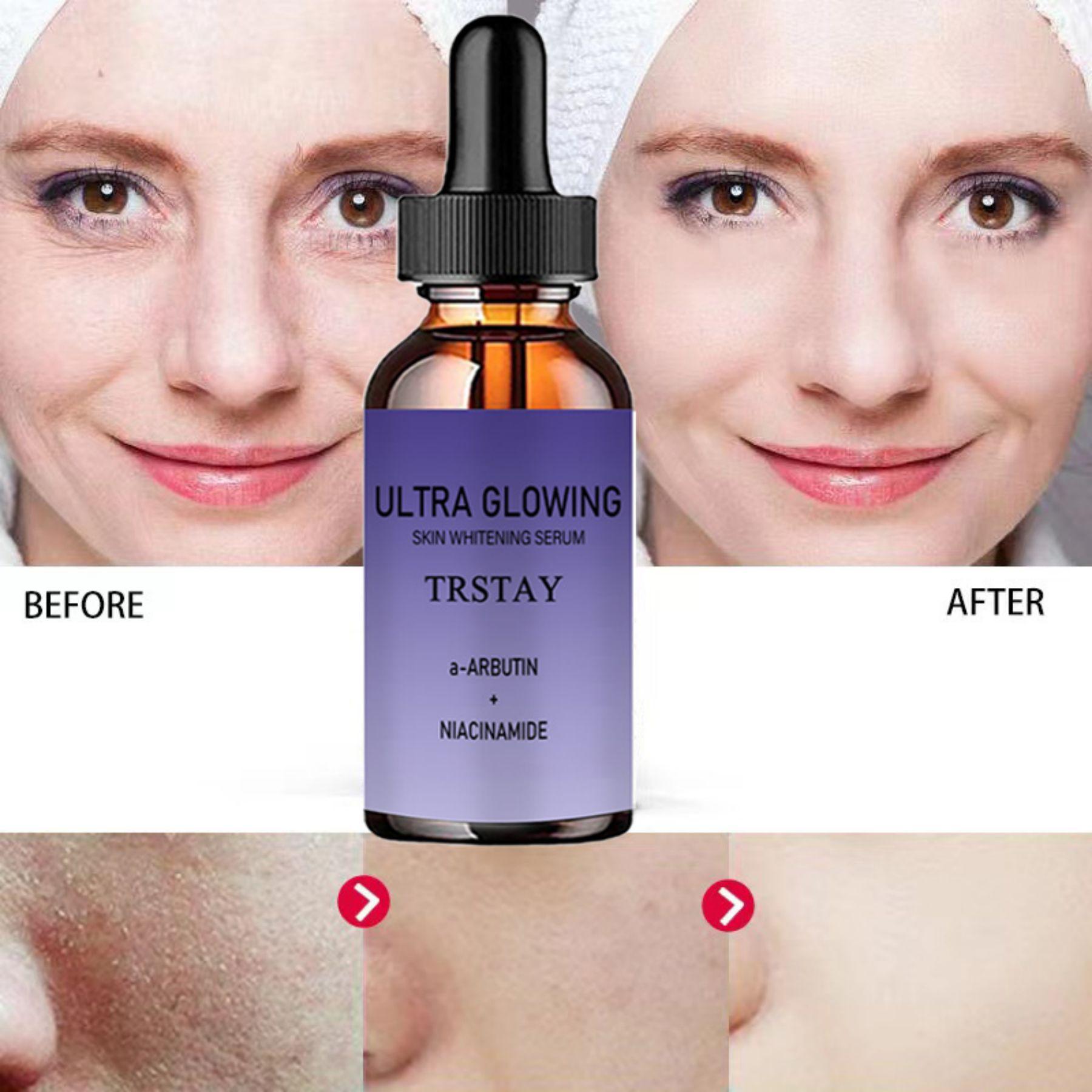 

5 мл/15 мл/30 мл/50 мл/TRSTAY Эффективный отбеливающий крем от веснушек Удаление темных пятен Крем для лица Удаление мелазмы Осветление Осветление Гладкая кожа Уход за кожей