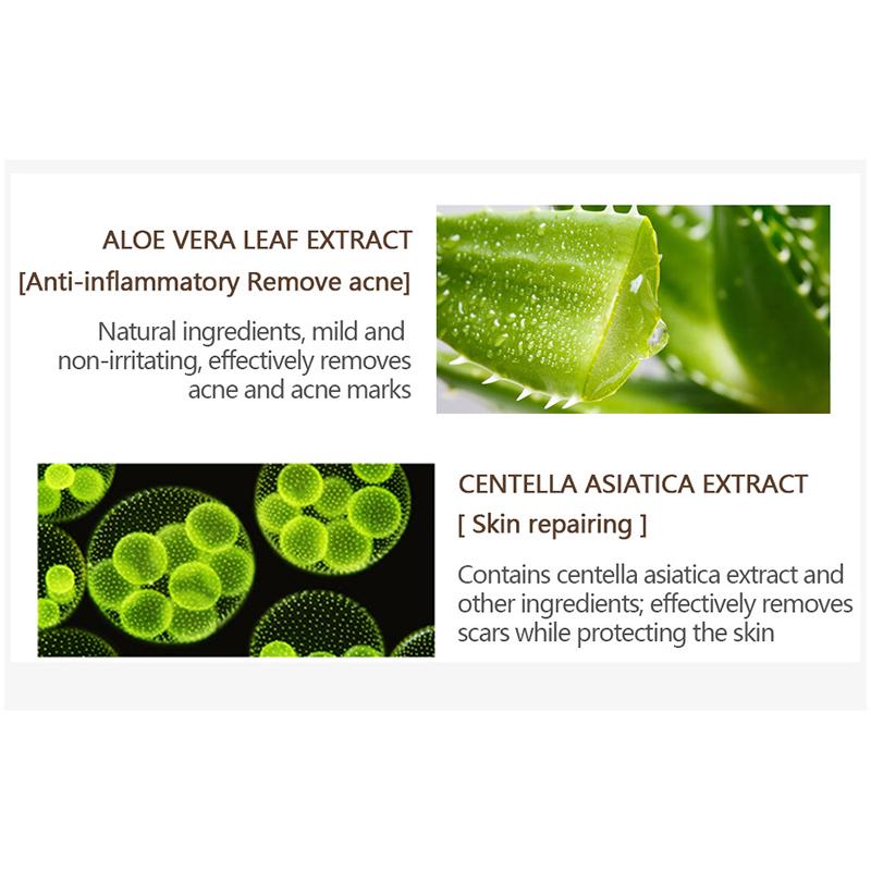 VIBRANT GLAMOUR Crocodile Repair Cream Acne Gel Fades Acne Marks Brightens and Moisturizes for Skin Care
