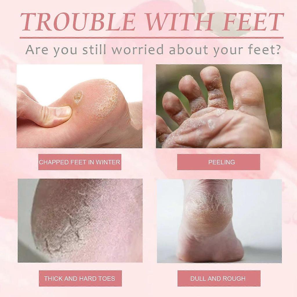 Eelhoe Peach Foot Mask Is A Foot Mask That Moisturizes, Hydrates, Smoothens And Rejuvenates The Skin, Prevents Dryness And Cracking, And Removes Dead