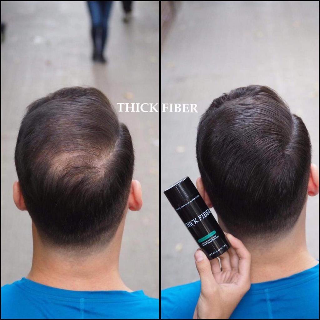 THICK FIBER Hair Fibers for Women & Men with Thinning Hair, Black, 12g | Conceals Bald Spots, Sparse Areas & Hairline | Natural Fuller-Looking Fini