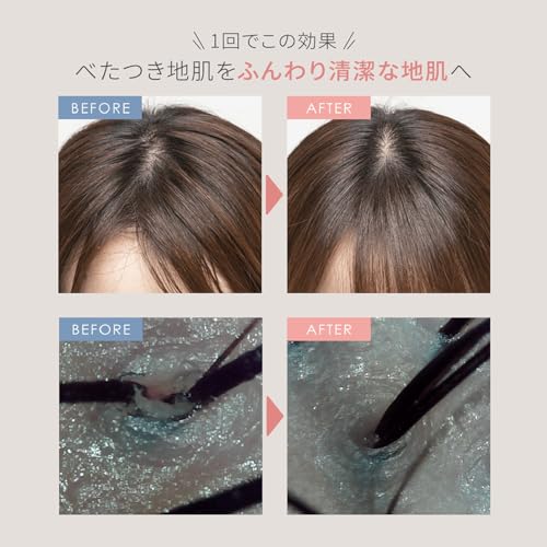 Ya-Man Head Spa Mise Needle Head Spa Lift Active Electric Scalp Brush MS32G Black