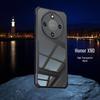 Xundi Silicone Drop-Proof Full Coverage Transparent Case for Honor X9D (Overseas Version)