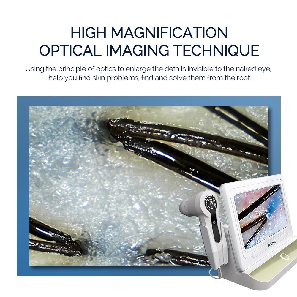 10 inch HD Display Professional Skin Analyzer 50X/200X Magnifying Pore Magnifier Hair Follicle Scalp Detector Skin Test Device