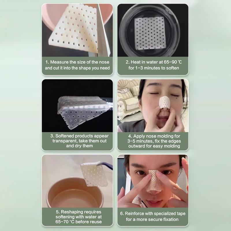 Low Temperature Thermoplastic Nose Splint Nose Job Rhinoplasty Splint Ortho Immobilized Thermoplastic Nose Nasal Fracture Splint