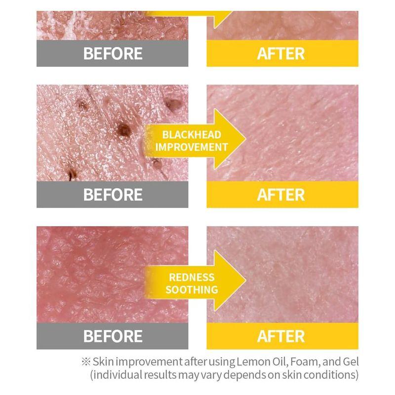 Secret Key Lemon Sparkling Cleansing Foam