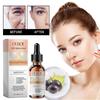 Ouhoe Kollagen Anti-Aging Essenz zur Reduzierung feiner Linien und Nasolabialfalten im Gesicht, Feuchtigkeitsspendende und Anti-Falten Essenz