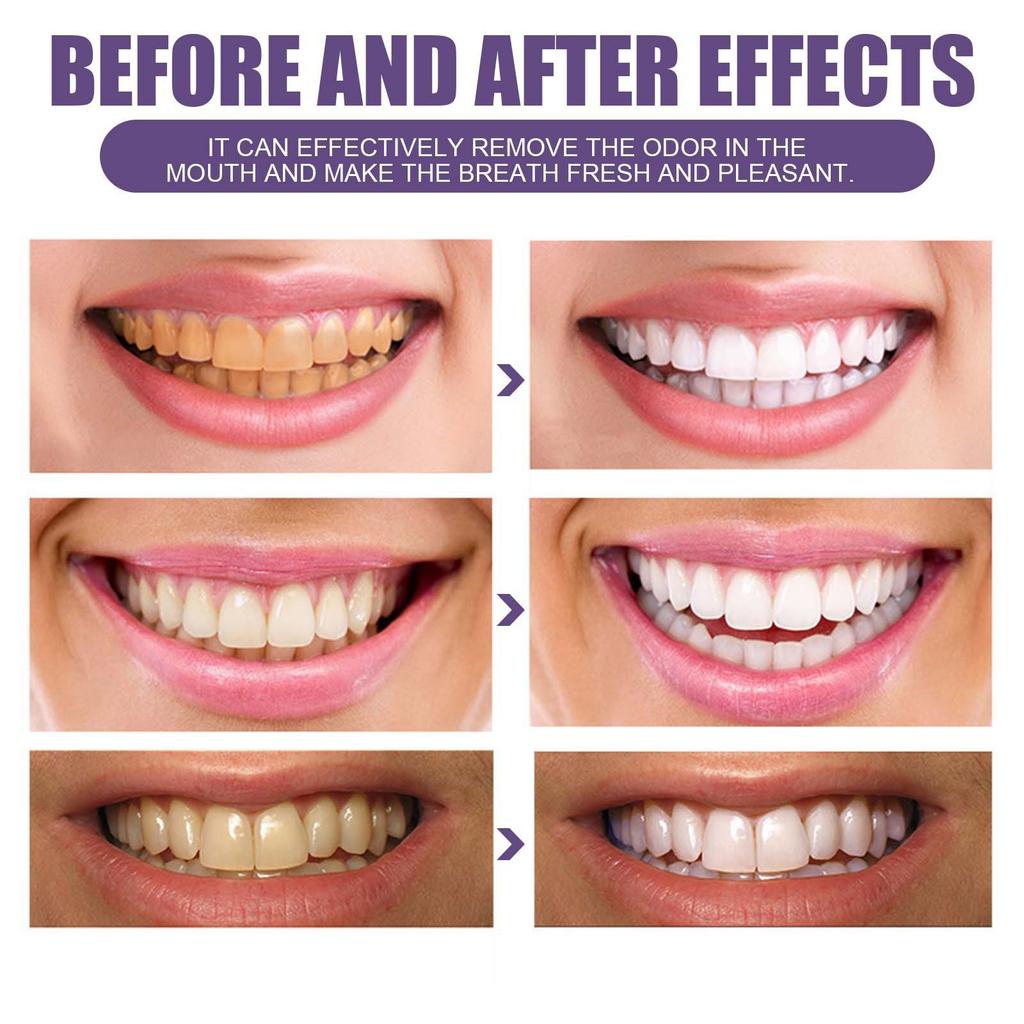 ORALHOE Polvere Viola per Denti – Sbiancante & Rinfrescante per l'Igiene Orale