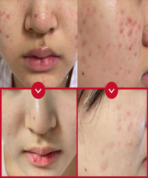 Bendermar Red Beruhigende Cica Exosome Toner Essenz