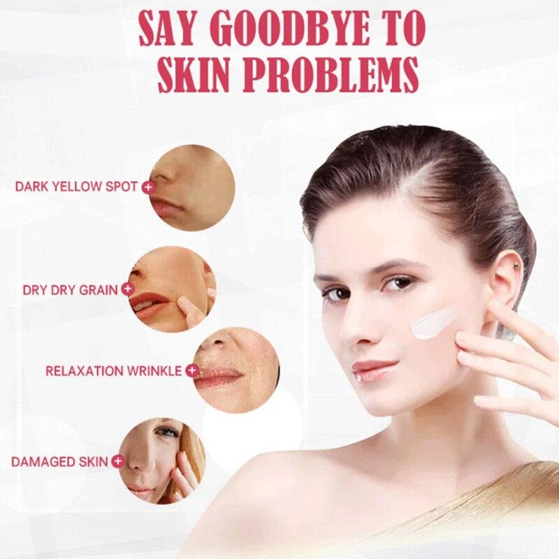 Lait anti-taches de rousseur pour le visage 30 ml Crème anti-taches noires pour le visage et le corps Crème anti-taches noires pour personnes âgées Pigment dilué Taches de rousseur