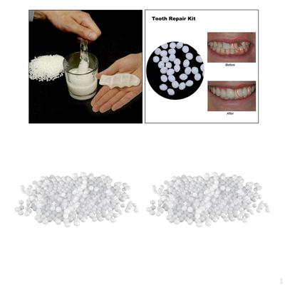 Kit de reparación de dientes temporales moldeables con cuentas de ajuste térmico de repuesto Dental