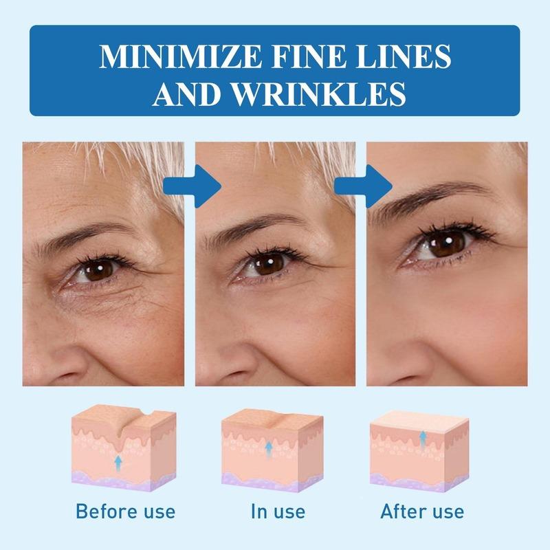 Anti Dark Circle Snake Eye Cream Skin Care Peptide Eye Bags Anti Wrinkle Hyaluronic Acid Cream Roller Massager Beauty Health