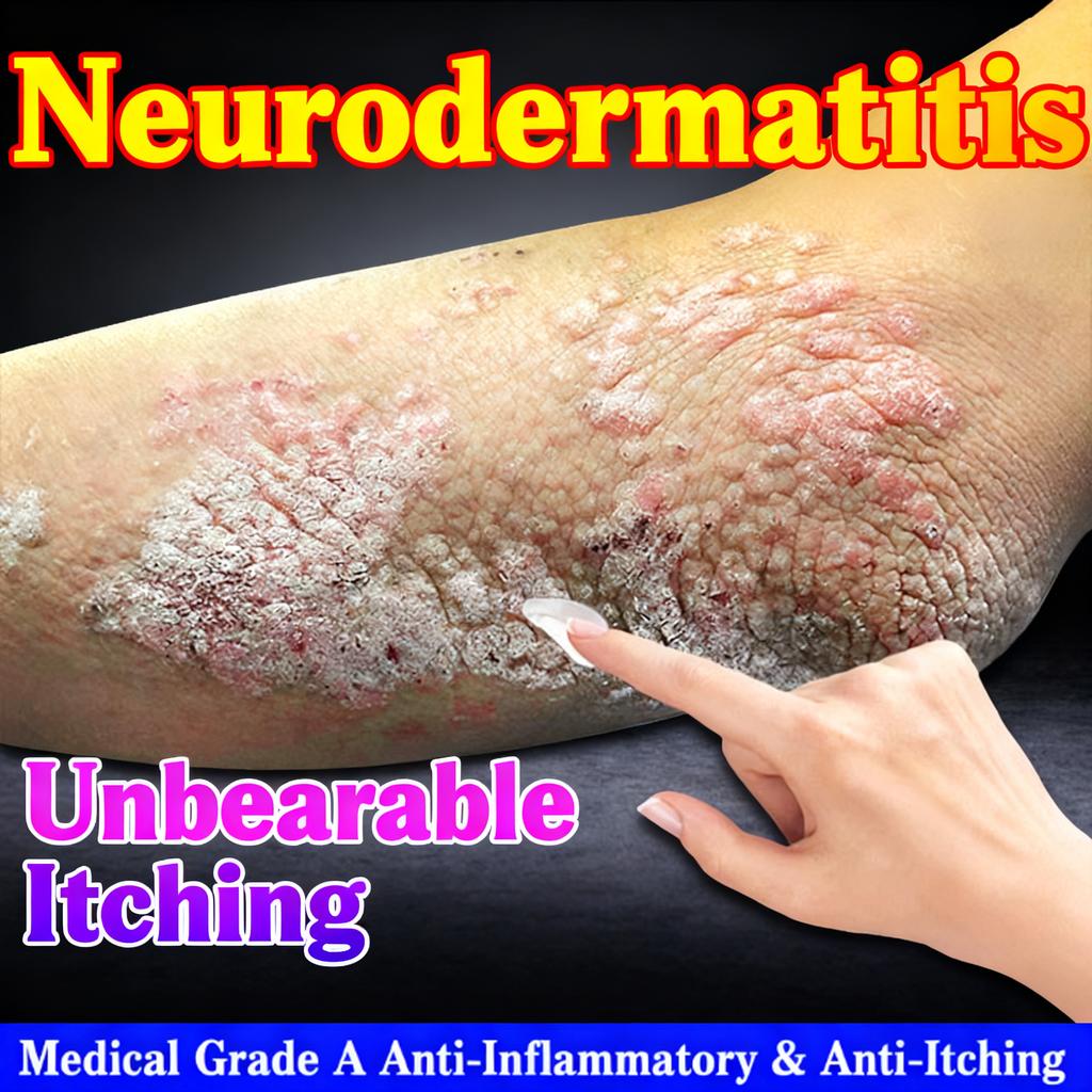 50g Eczema & Fungal Cream, Fast Acting Itch Relief for Dermatitis & Skin Allergies, Antiseptic Formula