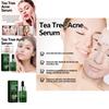 Eelhoe Green Tea Acne Serum Nourishing Antioxidant Formula For Brightening And Moisturizing