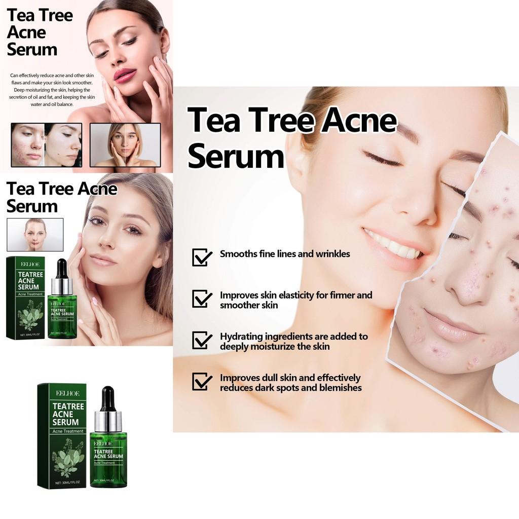 Eelhoe Green Tea Acne Serum Nourishing Antioxidant Formula For Brightening And Moisturizing