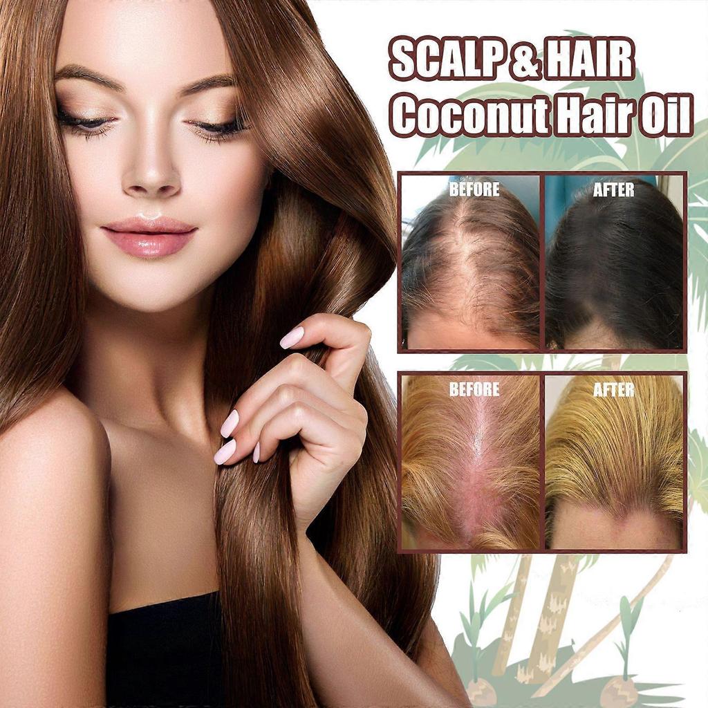 2025 Latest Model Coconut Hair Care Essential Oil Moisturizes and Strengthens