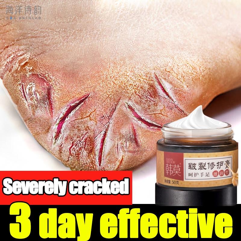 

Крем для восстановления ног, против сухих трещин, крем для восстановления пяток, для удаления омертвевшей кожи, увлажняющий уход за руками/ногами