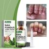 Conjunto Avançado Ximonth para Reparação de Unhas dos Pés e das Mãos para Cuidado de Unhas Saudáveis e Bonitas