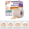 Flexible Silicone Scar Patches 4X150CM Scar Management Portable Scar Sheets for Adults Skin Repair Solution