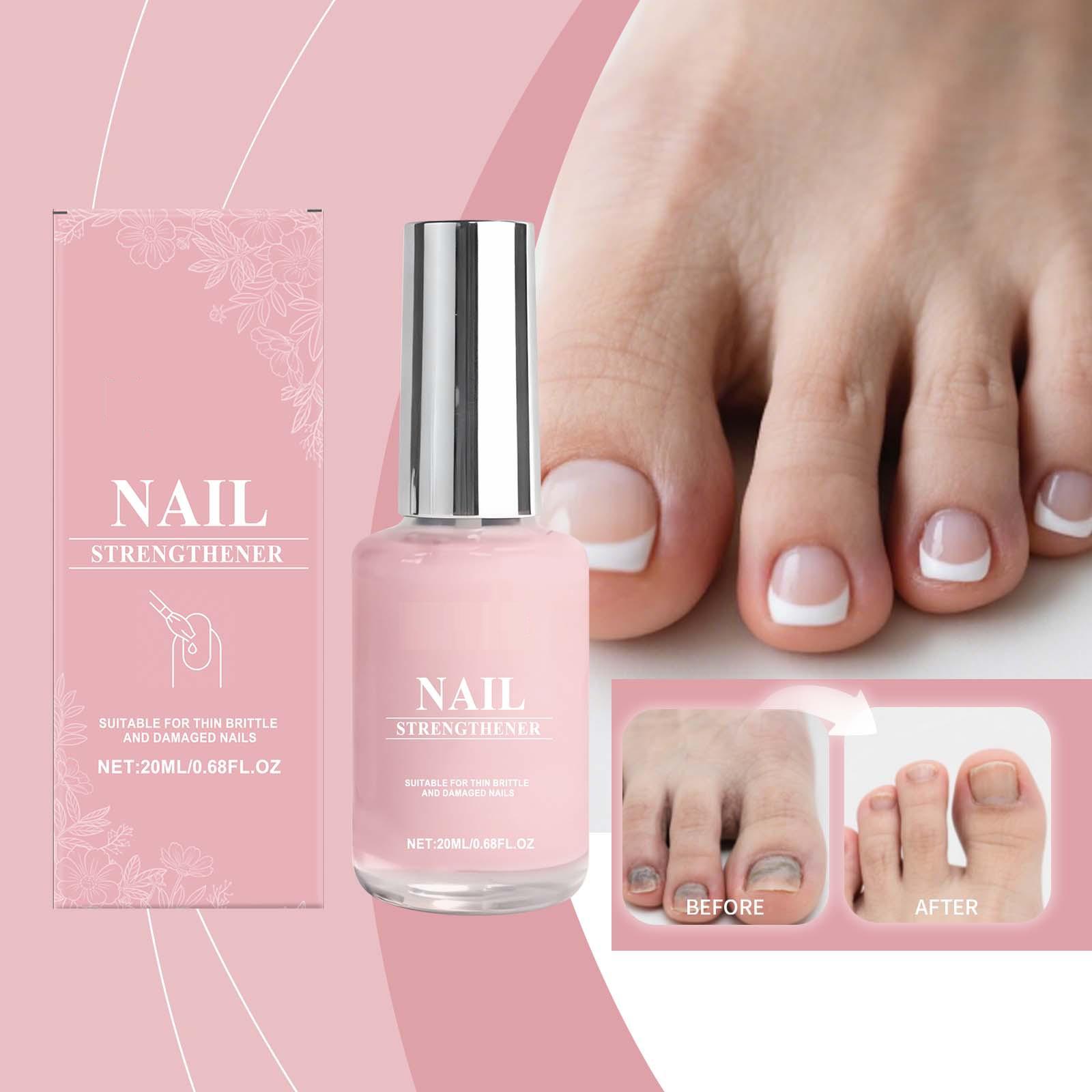 Nail Care Repairing Broken Stratum Corneum  Stratum Corneum Oil  Dry Stratum Corneum Care 20ml one size белый