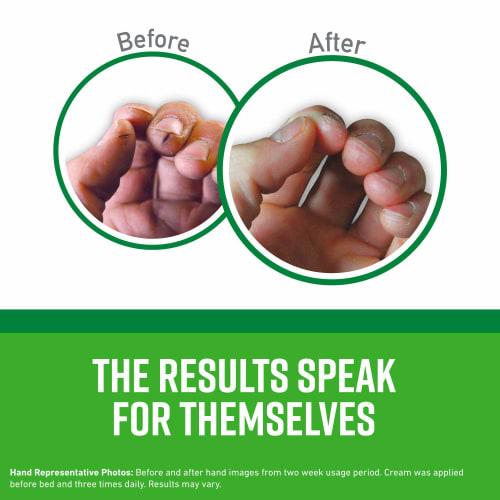 O'Keeffe's Working Hands Hand Cream, 3 Oz. Tubes, 5-Pack (K0290004-5)