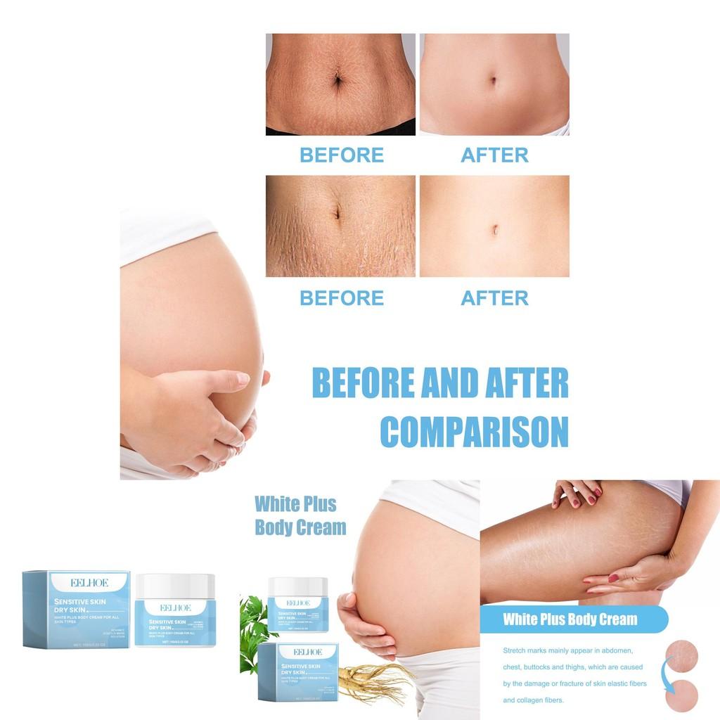 Eelhoe Stretch Mark Care Cream For Nourishing Skin With Collagen Firming Hydration