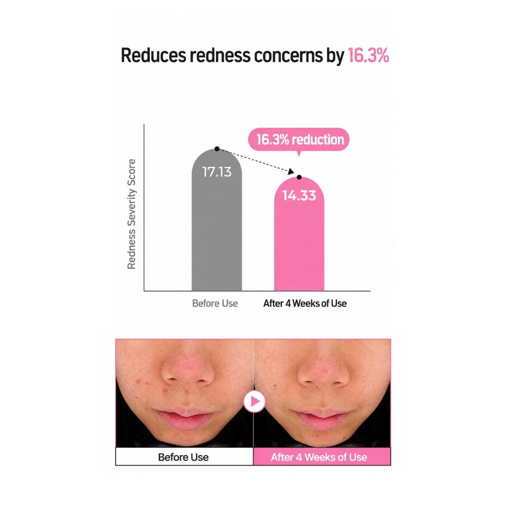 [asolution] Heartleaf Calamine Calming Acne Serum 60ml / 2.02 fl. oz