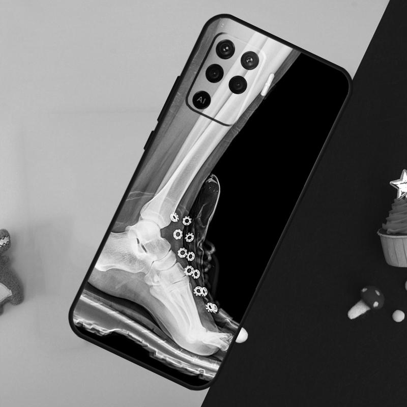 X-Ray Human Anatomy Case For Oppo A80 A60 A40 A54 A74 A94 A18 A38 A58 A78 A98 A96 A76 A16 A15 A17 A57 A5 A6 Pro