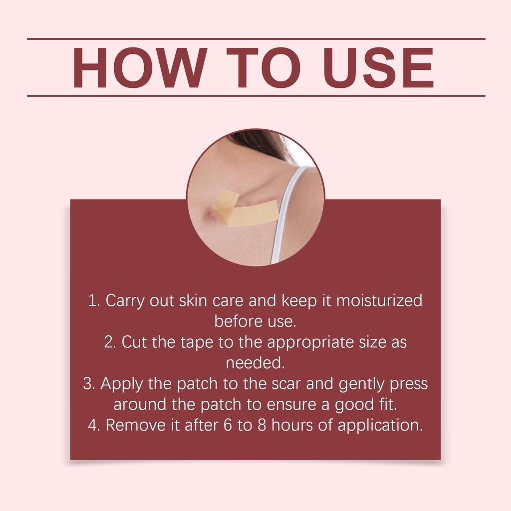 XIMONTH Scar Care Patches, Gentle Formula 24-Hour Breathable and Skin-Friendly Reduces Hypertrophic Scars