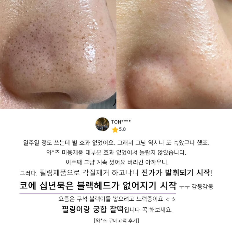 Acleon Large Capacity Dermatological Sebum Softener 1000ml