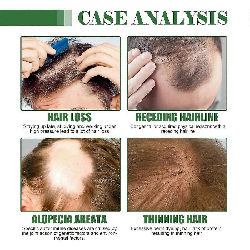 Batana Oil for Hair Growth, 100% Pure & Natural Raw Batana Oil,  Organic Raw Batana Oil from Honduras Care for Hair Thickner Longer & Scalp & Skin