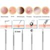 Facial Care Beauty Set Face Ice Roller Stainless Steel Gua Sha Board Massage Roller Acne Blackhead Remover Clip Skin Care Tools