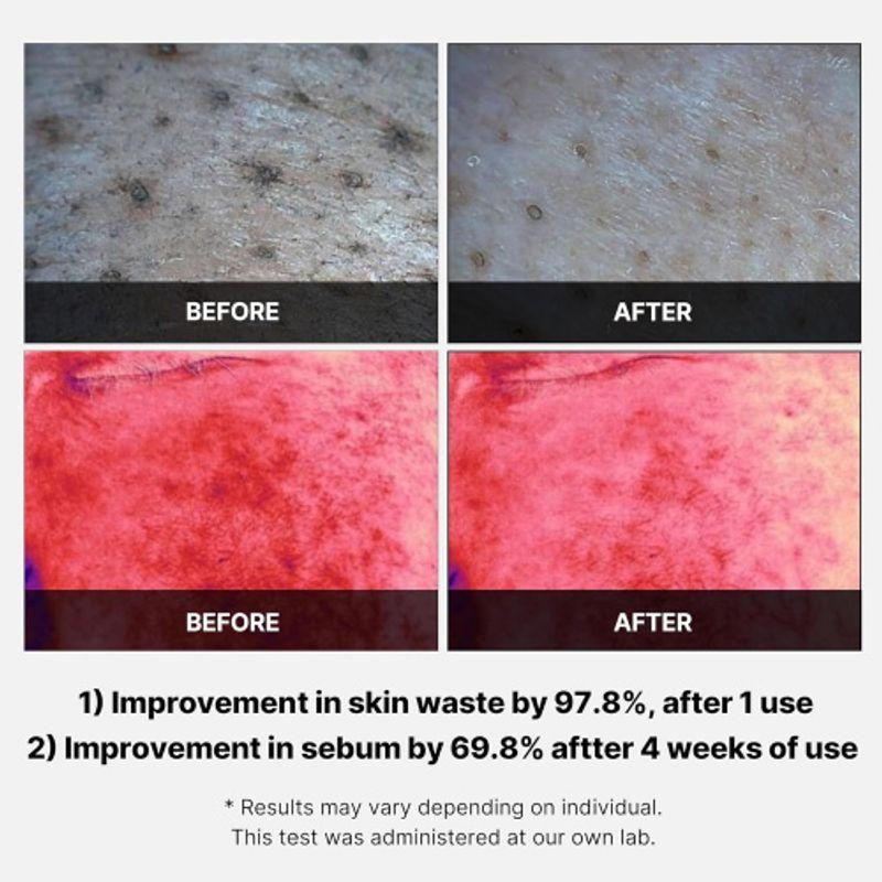 Medicube Red Succinic Acid Peeling Pad (70ea)