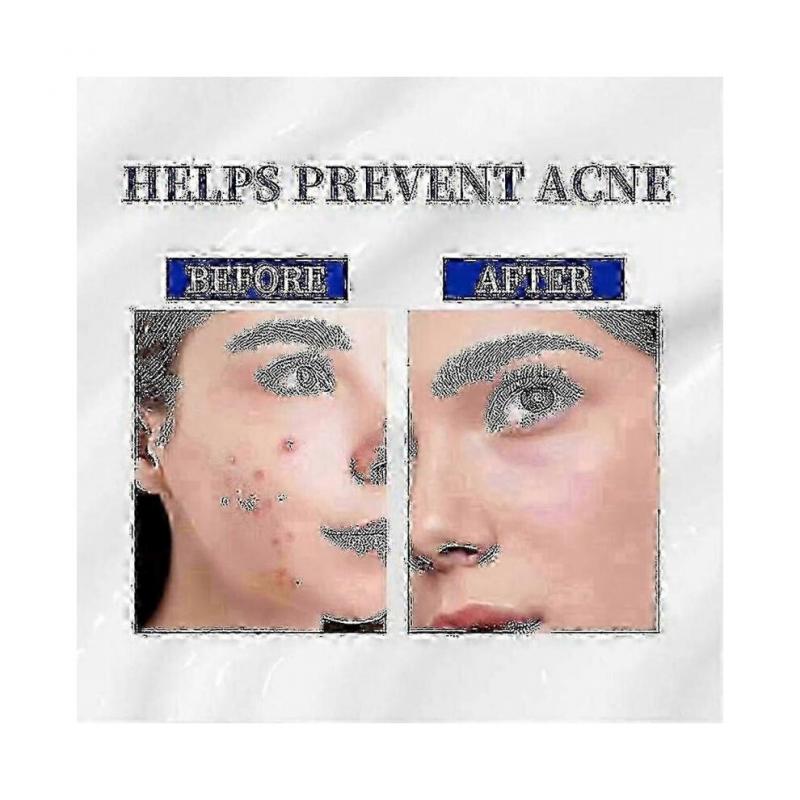 2 Stück A-313 Vitamin A Retinol Creme A~313 Retinol Anti-Aging Creme für das Gesicht, reduziert Poren & Falten, behandelt Akne & dunkle Flecken